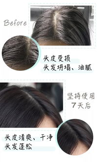 秋冬身体护理攻略 脱发、起皮一招解决，这些神器你得有！